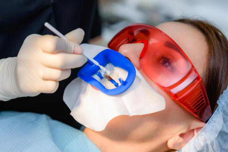 https://lakemagdalenedental.com/wp-content/uploads/2025/06/imgi_8_preparing-oral-cavity-whitening-with-ultraviolet-lamp-closeup_114354-2874.png
