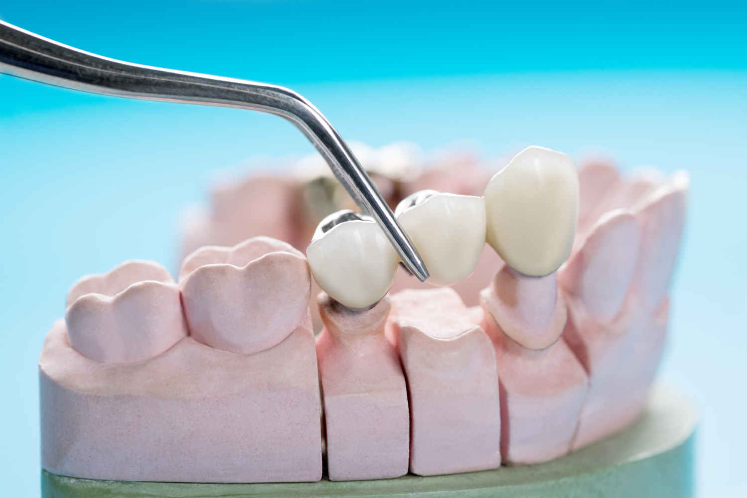 https://lakemagdalenedental.com/wp-content/uploads/2025/07/890.jpg