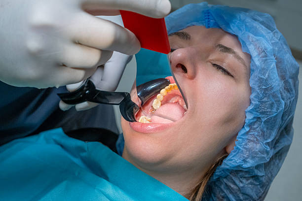 General Dentist Tips for Reducing Tooth Sensitivity