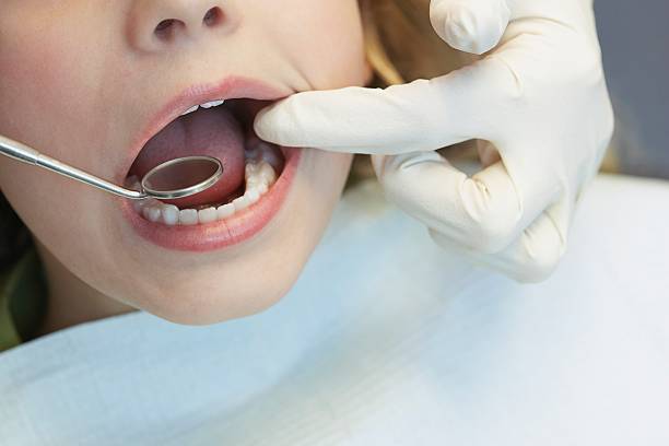 What a General Dentist Can Do For Tooth Whitening