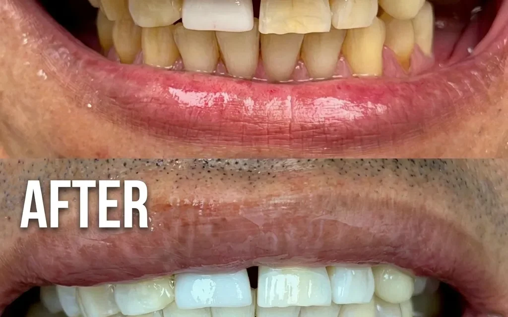 Best General Dentist Near You for Routine Cleanings