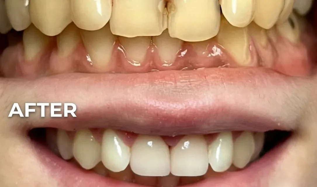 General Dentist for Emergency Tooth Pain Relief Today