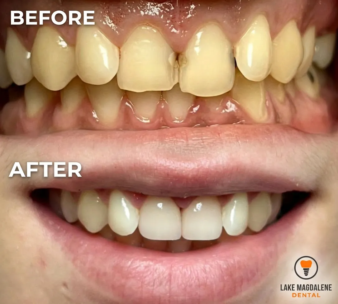 General Dentist for Emergency Tooth Pain Relief Today