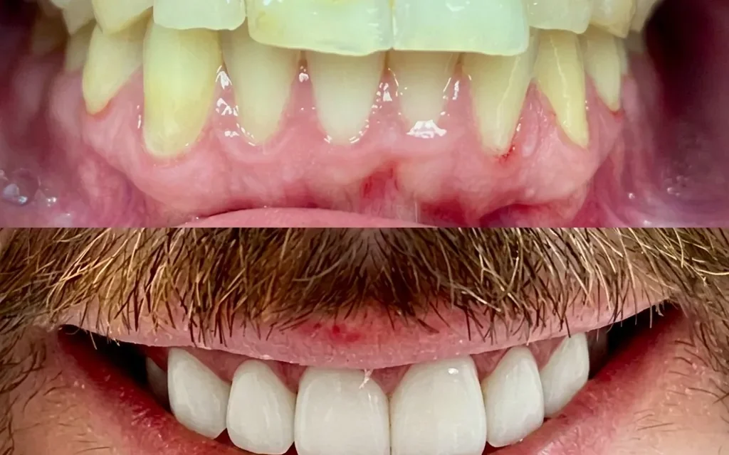 Trusted General Dentist for Complete Smile Restoration