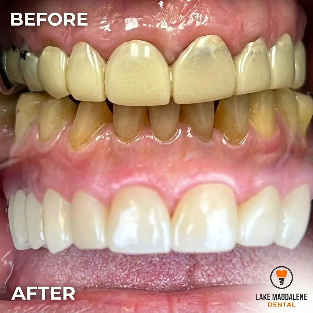 imgi_1_tfbjMiVG https://lakemagdalenedental.com/wp-content/uploads/2026/03/imgi_1_tfbjMiVG.webp